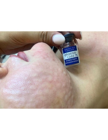 Hyamino Care 75